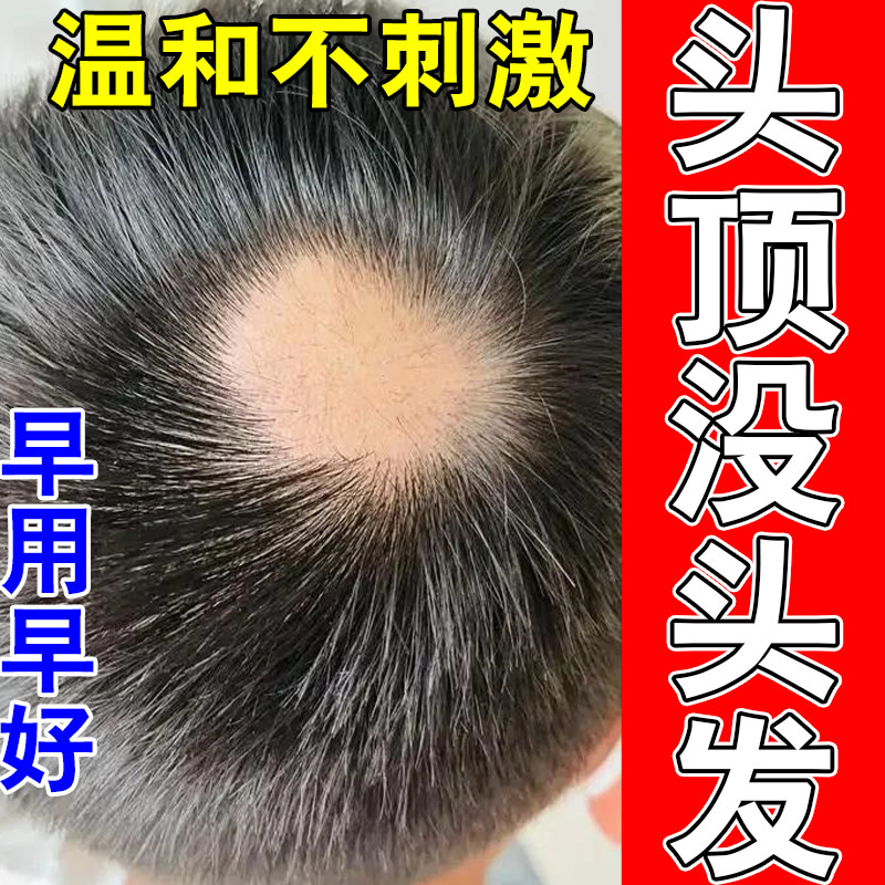 头顶上毛囊变少掉发后脑勺光秃露头皮修护受损发根深层修护喷剂