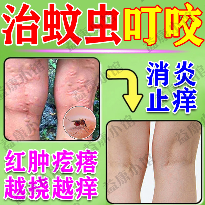 蚊虫叮咬快速止痒消肿儿童宝宝成人专用药皮肤瘙痒舒缓清凉消包药