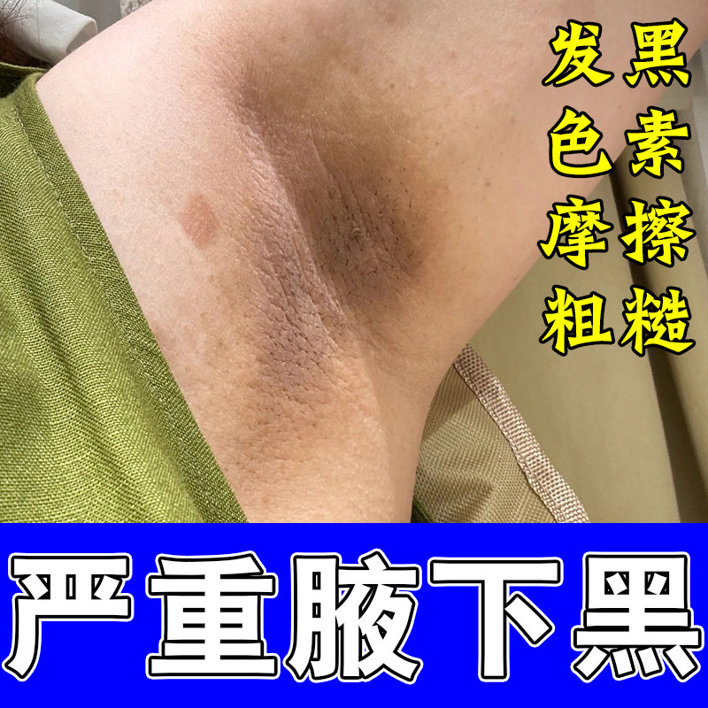 腋下肌肤粗糙腋窝颜色发黑胳肢窝褶皱暗沉腋下老废角质堆积按摩膏