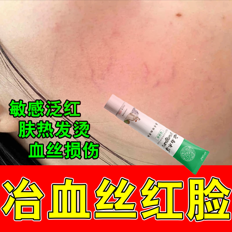 脸上的红血丝皮肤角质层薄修复大红脸面部泛红屏障舒缓保湿乳膏