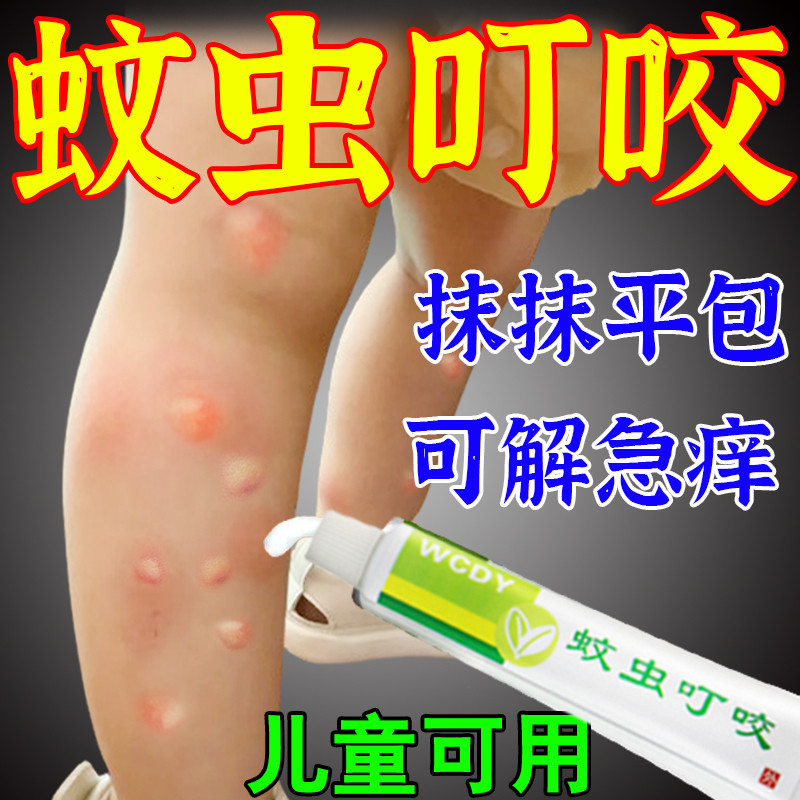 蚊虫叮咬止痒消肿止痒膏防蚊虫跳蚤毒虫臭虫咬伤居家户外需要神器