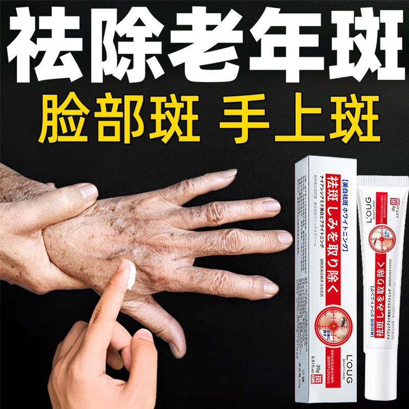 去祛黄褐斑老年斑药膏专用强力去除手部脸部霜除黑班正品旗舰店店