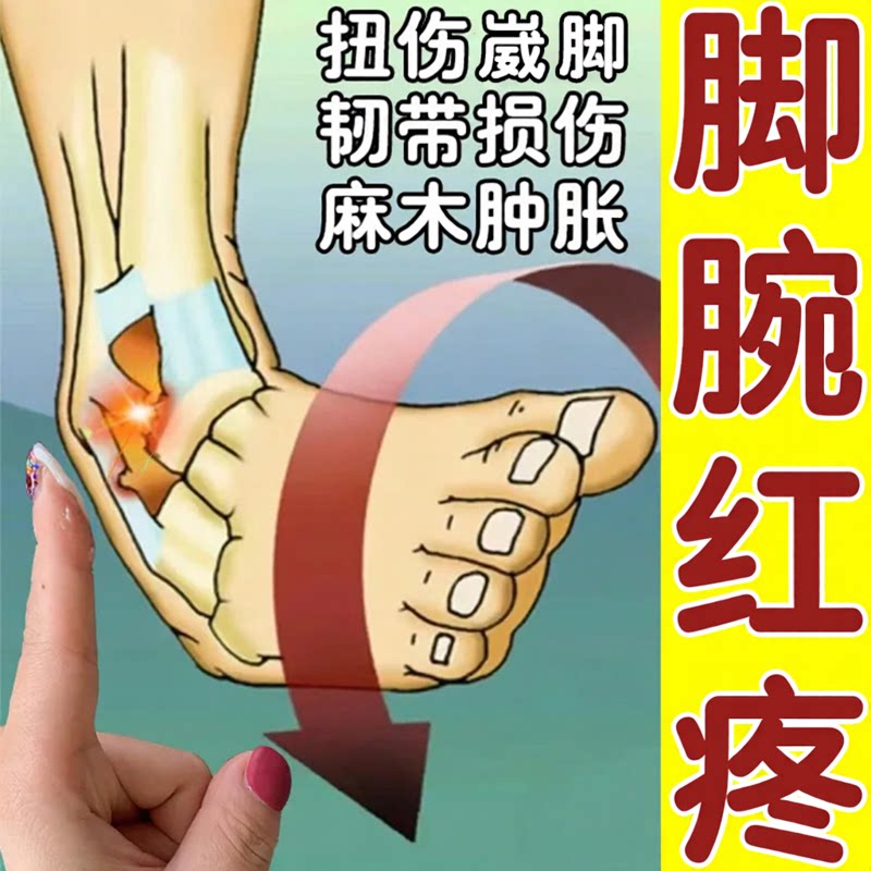 崴脚扭伤药治脚腕痛陈旧老伤关节韧带红肿恢复药水