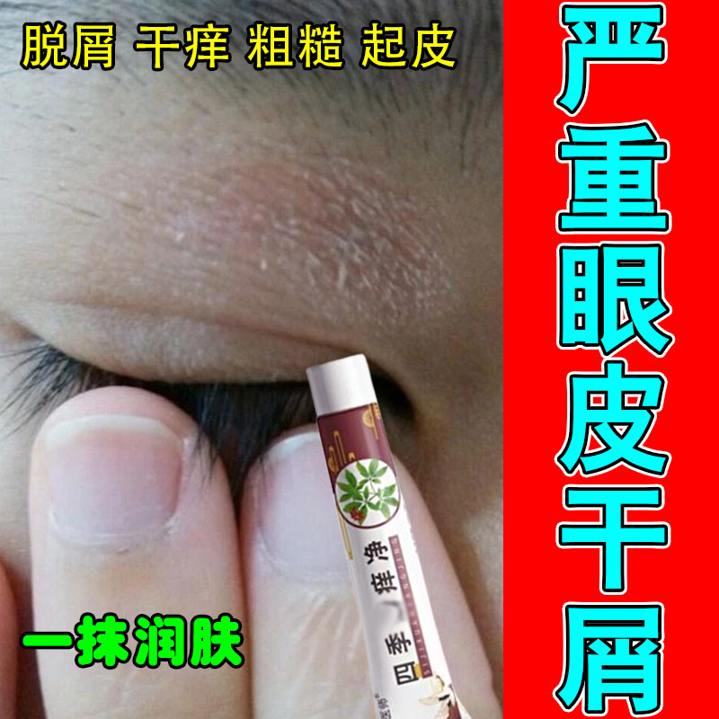 眼皮红肿粗糙痒起皮眼周过敏眼皮痒干燥掉屑神经舒缓修护膏