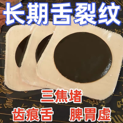 齿痕舌湿热贴湿气湿寒舌苔锯齿状消化不良排便不畅排湿疏通三焦贴