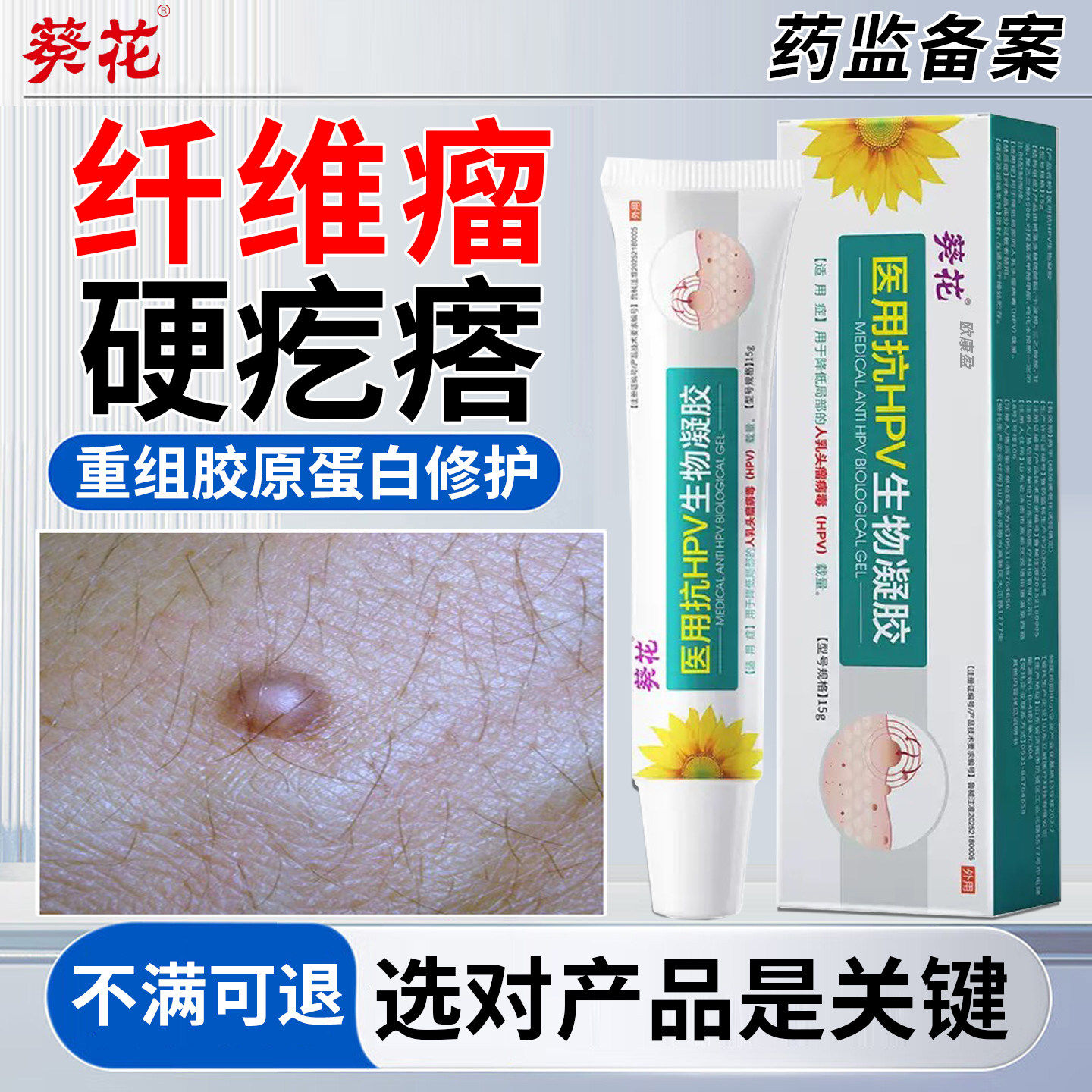葵花除疣型医用退热凝胶祛疣灵膏小肉粒去疣膏非斩草除根医用级