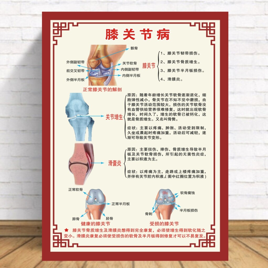 中医养生馆美容院膝关节增生解剖图挂画挂图宣传海报定制KT板包邮