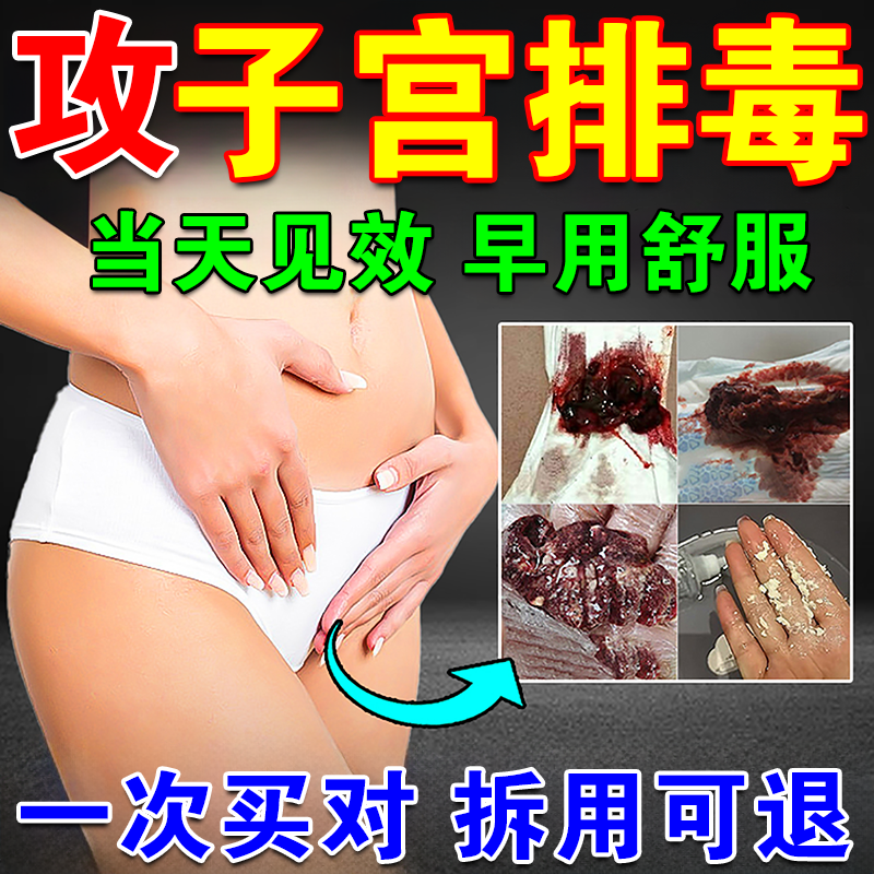 妇科清宫丸中药排毒正品阴道排脏紧致缩女性子宫卵巢保养私处护理