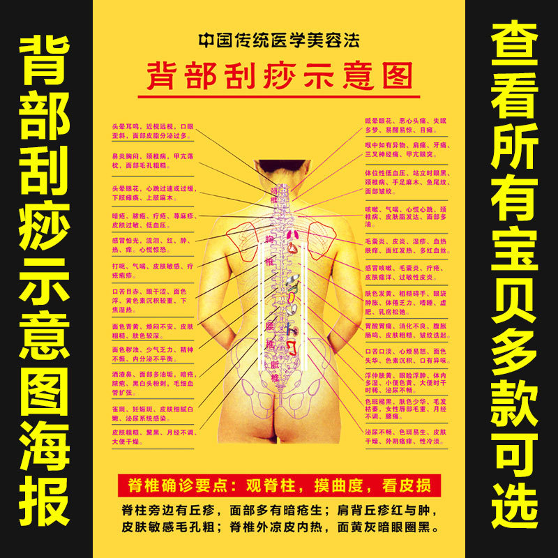背部刮痧示意图养生馆美容人体穴位挂图 中医宣传海报 脊背确诊