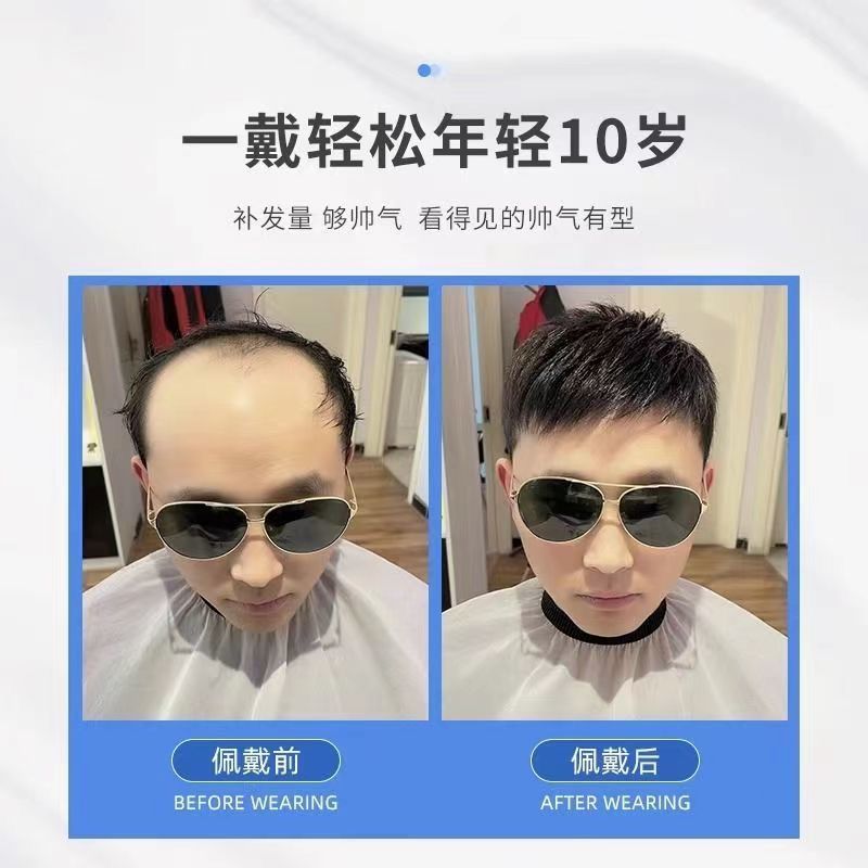 假发男短发毛寸造型自然全真发假发片清爽透气男士碎盖头顶补发片