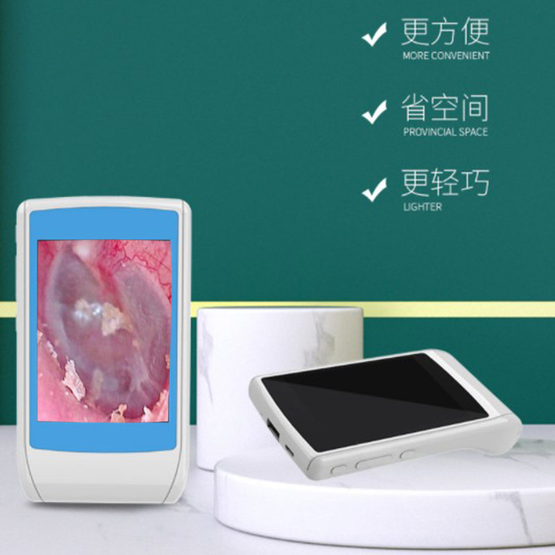 便携式高清可视j耳镜采耳仪器设备耳朵窥视镜掏耳朵神器工具看耳