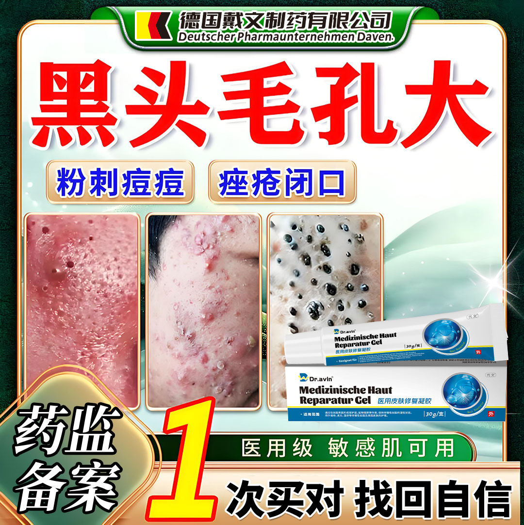收缩改善毛孔粗大修复去黑头粉刺闭口油皮医用透明质酸钠精华液AH