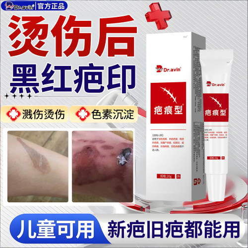 热油油烫伤烧伤去疤膏疤痕修复除疤膏儿童祛去红印黑印色素沉淀wj