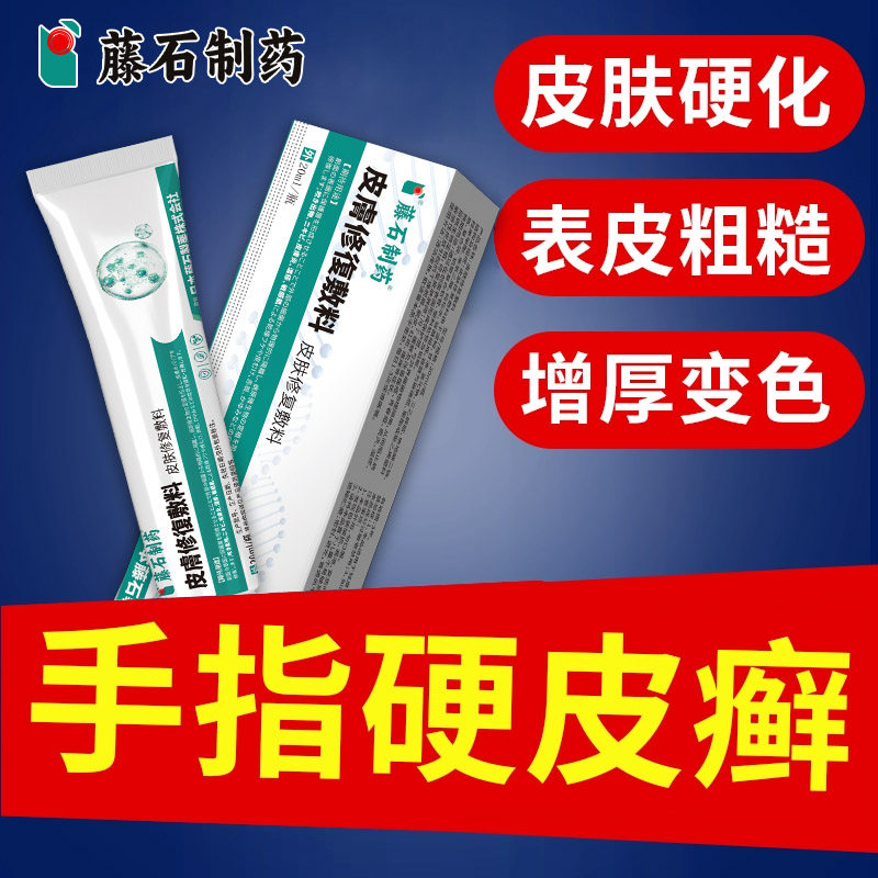 手指硬皮癣皮肤硬化表皮粗糙增厚变色干裂软化角质干燥脱屑AH