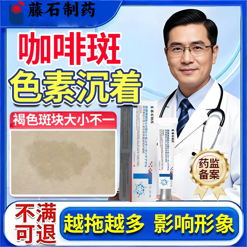 儿童胎记去牛奶咖啡斑激光防晒去神经性纤维瘤药监备案软膏YK