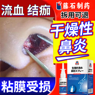 干燥性鼻炎流血结痂粘膜受损流鼻血疼痛干燥鼻痒用专药监备案YK