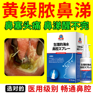 慢性鼻窦炎鼻炎黄绿浓鼻涕多倒流鼻塞排脓肥大用专药监认证喷剂YK