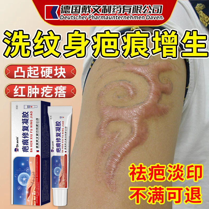 洗纹身疤痕增生疙瘩凸起硬肉疤痕膏护理神器烫伤医用凝胶AH