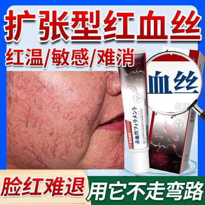 藤石制药红血丝次血丝护理膏