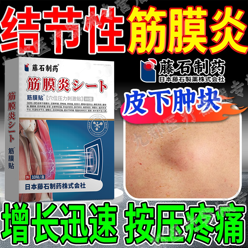 结节性筋膜炎手臂小腿皮下鼓包肿块肌肉拉伤硬结疼痛可搭膏药贴AH
