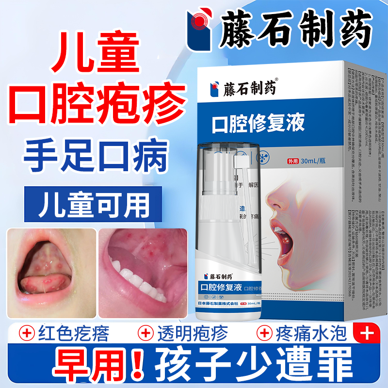 儿童口腔疱疹性咽峡炎感染手足口病腔溃疡可搭干扰素a2b喷雾器AH