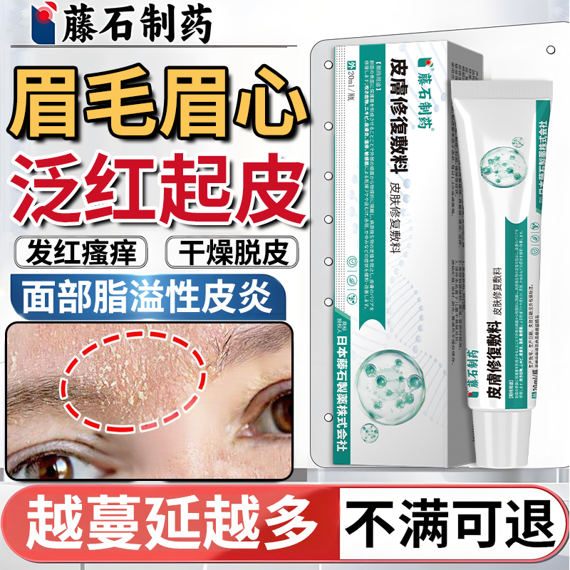 面部脂溢性皮炎修复软膏