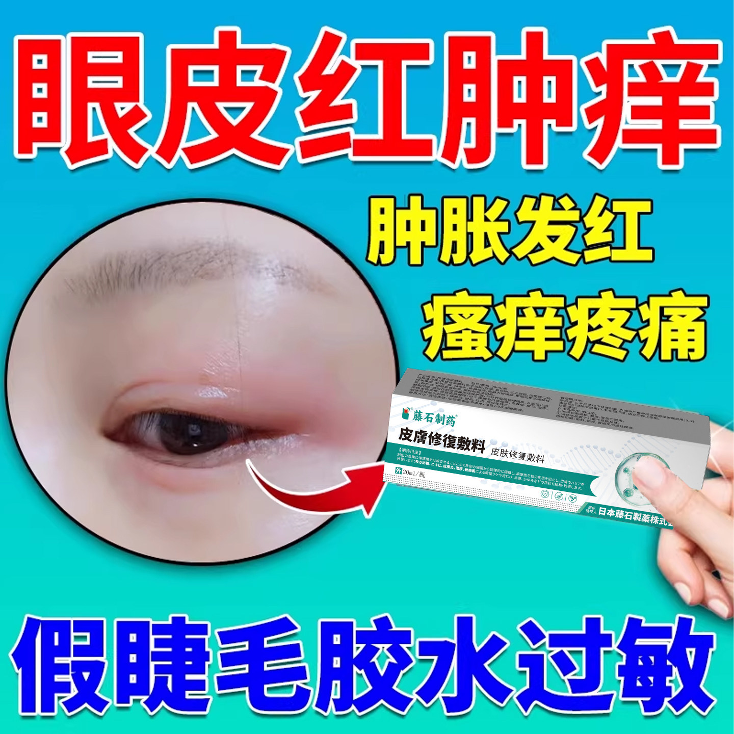 假睫毛胶水过敏涂什么眼睛肿胀红瘙痒疼痛兔胶假睫毛药监备案膏AH