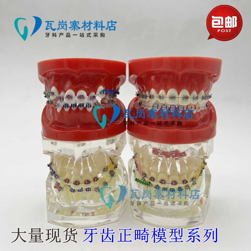 牙科正畸模型 h透明错颌矫正展示模型 结扎丝托槽正畸带支抗钉牙