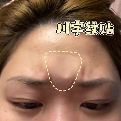 川字纹贴睡觉专用眉间额头贴面部提拉隐形贴紧致抬头纹防皱纹神器