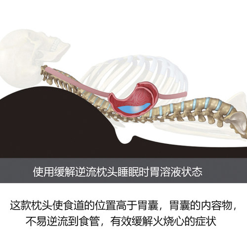 老人卧床大靠背床头靠垫胃食管防反流F斜坡枕孕妇哺乳半躺三角靠