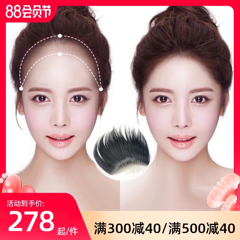 速发假发片士发际线假发贴前额补发片额顶真人发丝高秃头补发块