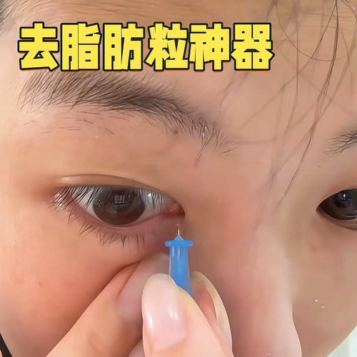 一次性粉刺针闭口针祛痘针去黑头