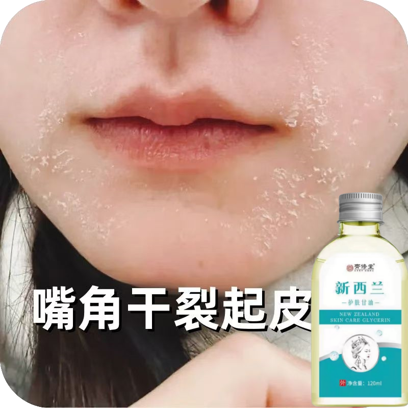 脸部干燥起皮脸干痒泛红刺痛掉皮屑秋冬面部干皮爆皮皮肤粗糙脱皮
