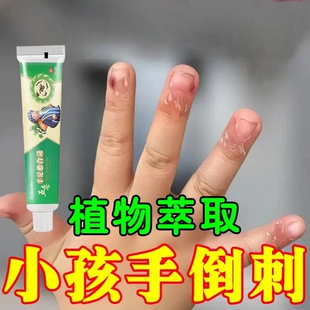手指长倒刺修复受损营养油去倒刺神器儿童手上边缘干裂脱皮起皮膏
