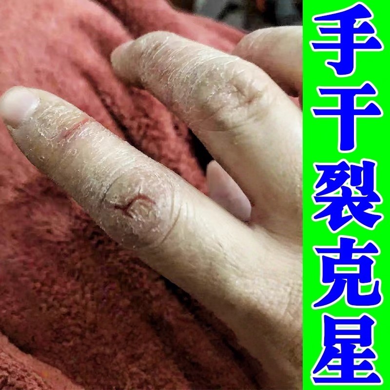 手干裂修复膏手指裂口干裂粗糙手指头开裂口子疼痛脱皮干燥愈合膏,洗护清洁剂/卫生巾/纸/香薰,护手霜,淘宝优惠券,粉丝福利购,淘宝优惠卷
