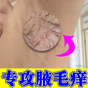 腋毛痒白色附着物膏药腋下红肿疼腋窝出汗有异味黄色结晶修复乳膏