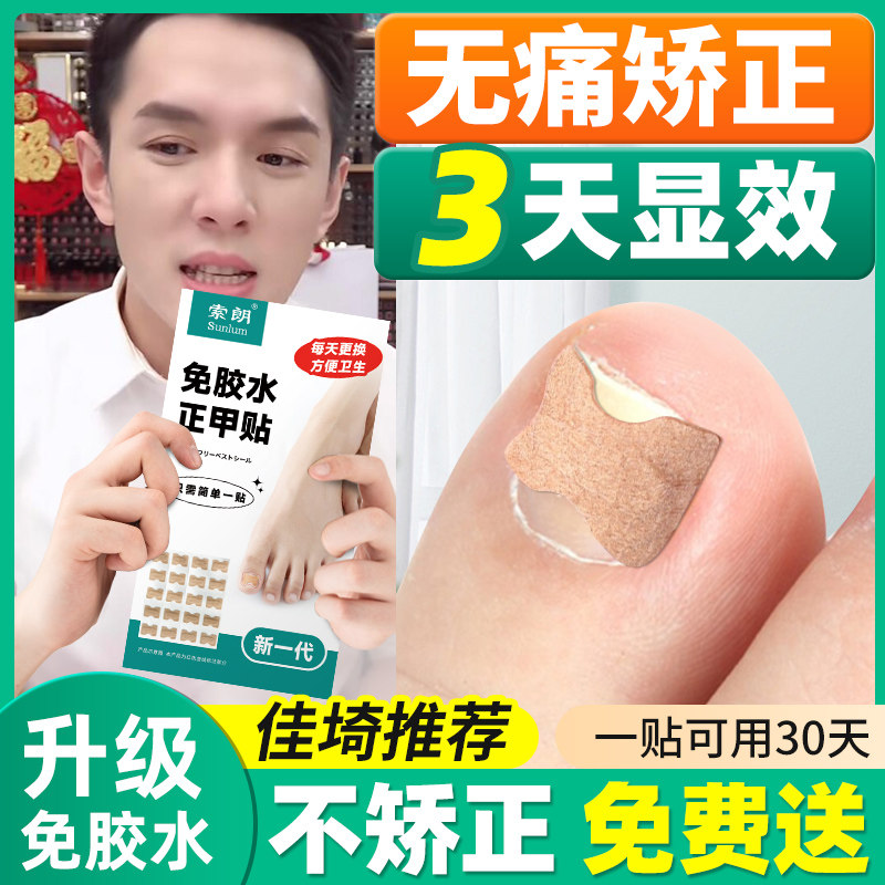 速发正甲贴甲沟嵌甲矫正脚指甲用正器甲沟专纠矫正贴脚甲甲沟正趾