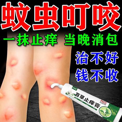 蚊虫叮咬快速止痒消肿药膏治婴儿宝宝成人臭虫跳蚤蚊子去黑印神器
