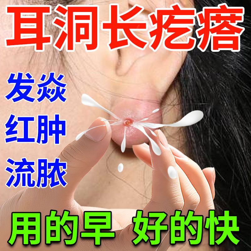 耳洞增生疤痕疙瘩去祛除护理液神器耳洞清洁发炎增生凸起滴耳专用