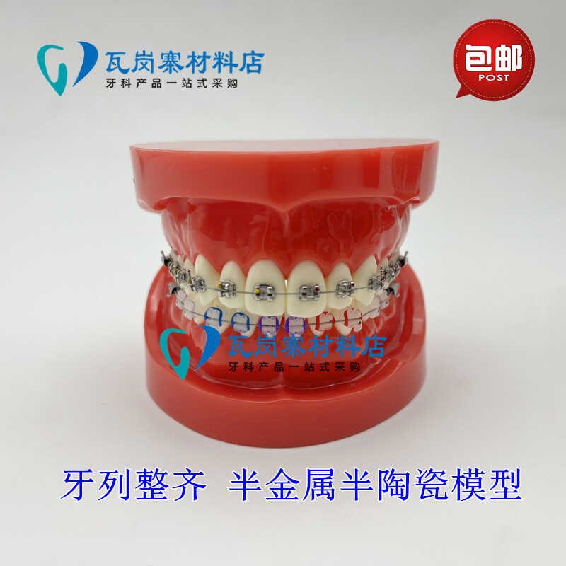 牙科正畸模型 透明错颌矫正展示模型 结扎丝托P槽正畸带支抗钉牙