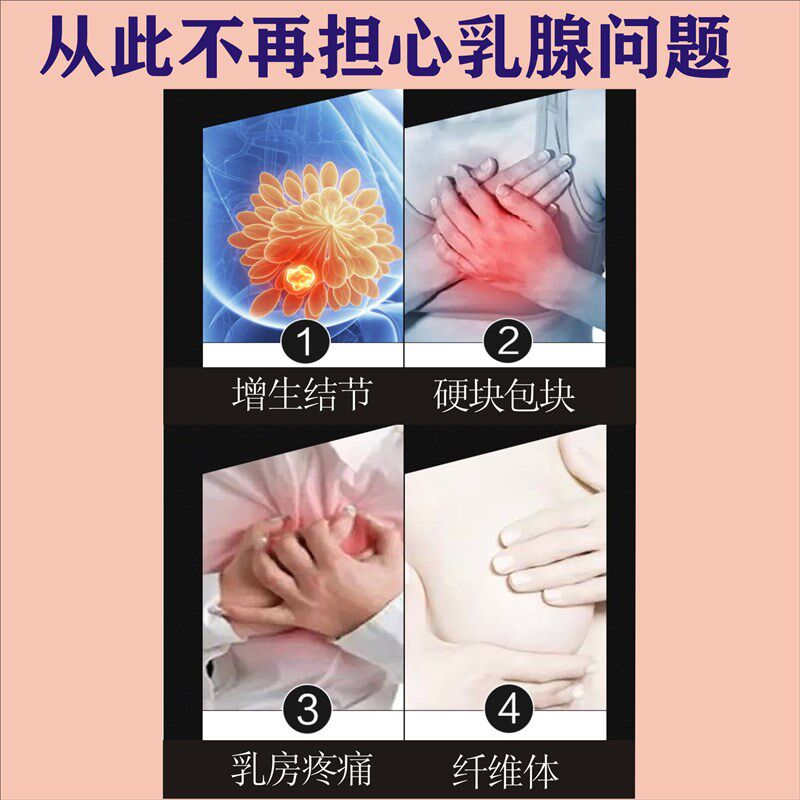 菊彦牌乳腺贴小叶硬块奶结经前乳房肿块K包块结节增生散结乳安贴
