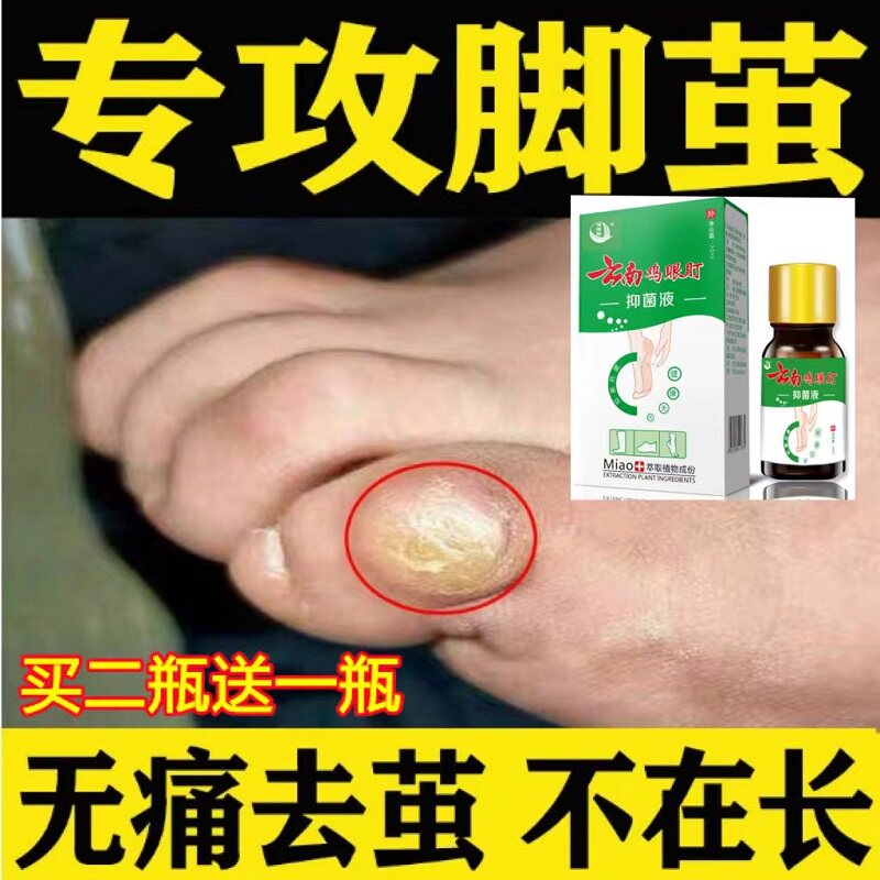 现货速发去脚底手指缝小脚趾关节茧厚硬死皮脚指头脚缝老茧子鸡眼