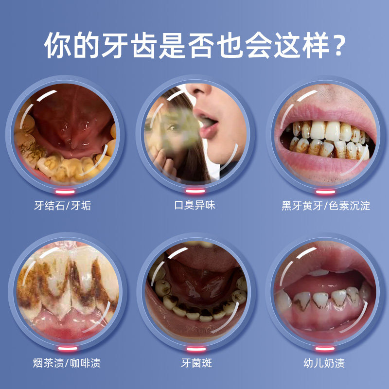 速发可视超声波洁牙器去除牙结石污垢清理神器牙齿牙垢牙石清洁洗