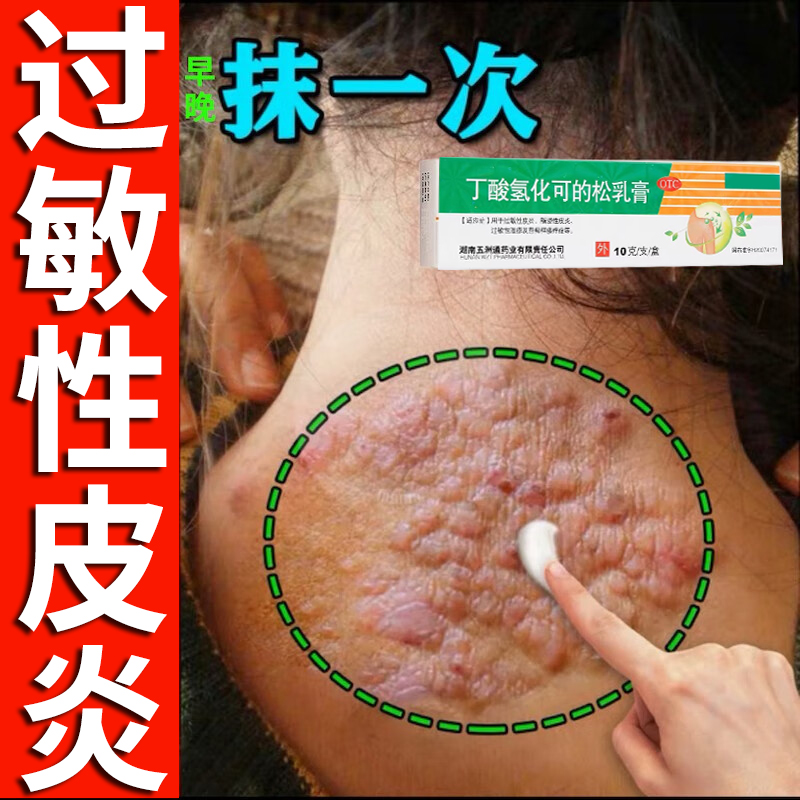 【丁轻】丁酸氢化可的松乳膏0.1%*10g*1支/盒