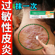 治疗过敏性皮炎外用膏顽固皮肤瘙痒湿疹过敏止痒抑菌消炎专用药膏