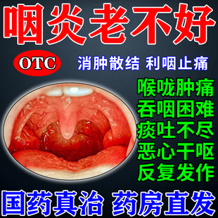 慢性咽炎咽喉炎喉咙有异物感干痒咳嗽咽炎特效专用药冬凌草片正品
