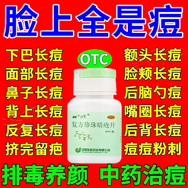 【速笑】复方珍珠暗疮片300mg*84片/盒