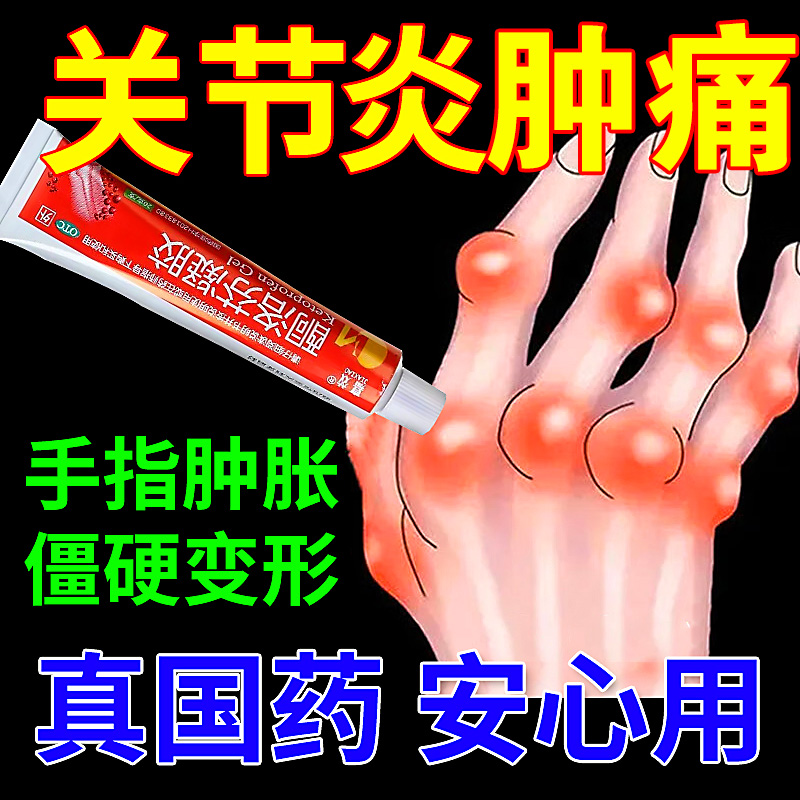 治疗风湿关节炎药膏风湿类风湿疼痛关节僵硬肿手指变形酮洛芬凝胶