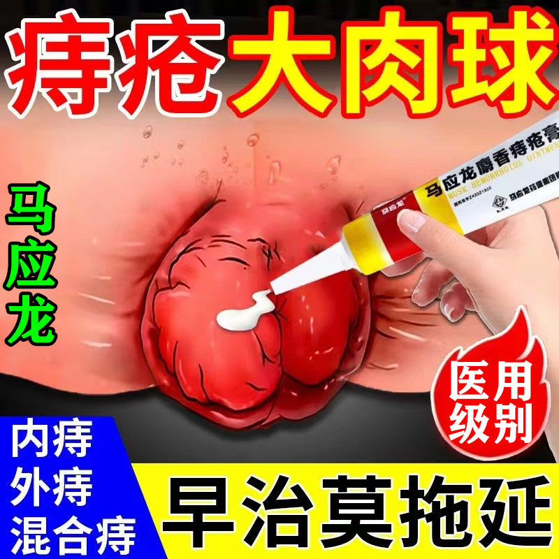 马应龙痔疮膏正品官方旗舰店正品内痔外痔混合痔痔疮药膏排行榜第