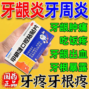口腔溃疡贴特专用效药口腔牙周炎药物牙疼止疼药速消炎止痛效贴片